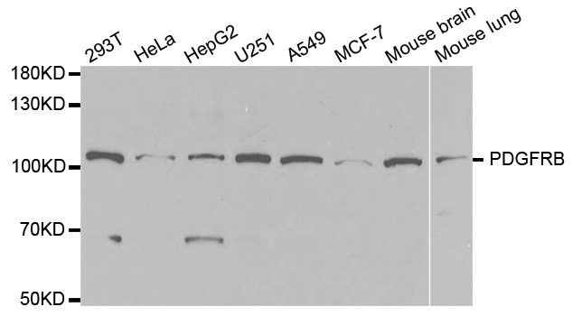 Anti-PDGFRB Antibody