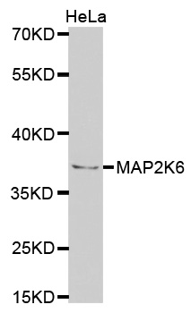 Anti-MAP2K6 Antibody