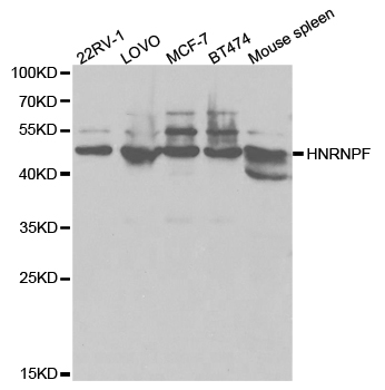 Anti-HNRNPF Antibody