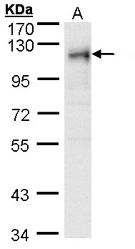 Anti-ribosome binding protein 1 Antibody