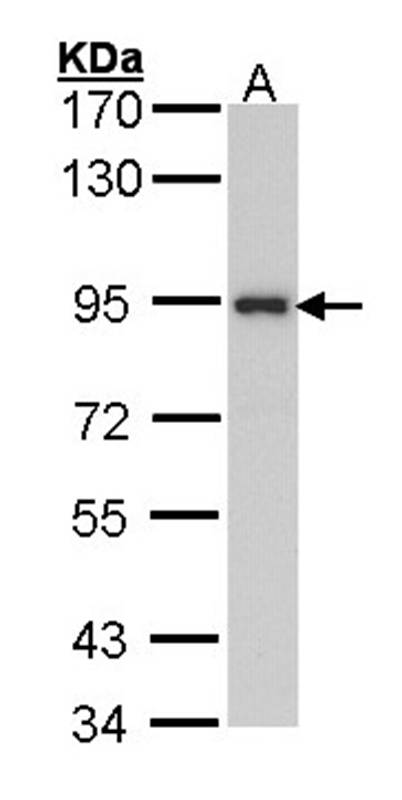 Anti-ribosome binding protein 1 Antibody