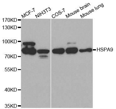 Anti-HSPA9 Antibody