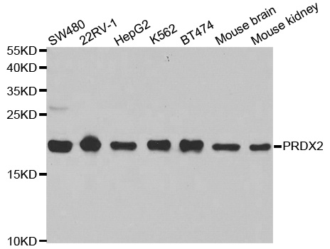 Anti-PRDX2 Antibody