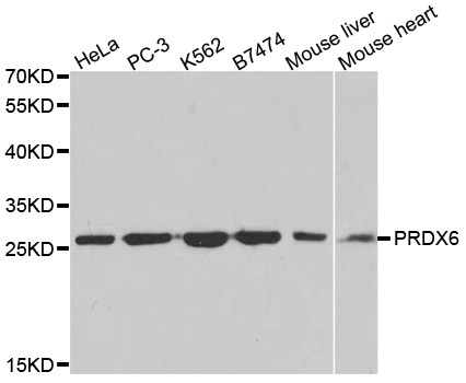 Anti-PRDX6 Antibody