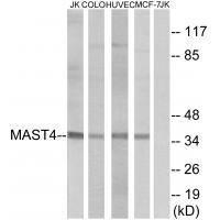 Anti-MAST4 Antibody