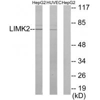 Anti-LIMK2 Antibody