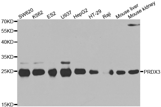 Anti-PRDX3 Antibody