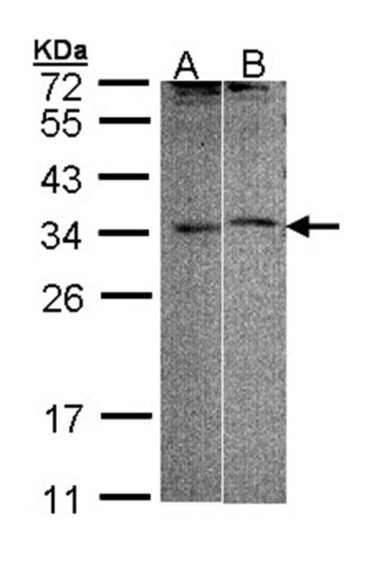 Anti-FHL5 Antibody