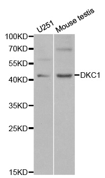 Anti-DKC1 Antibody