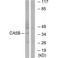 Anti-CA5B Antibody