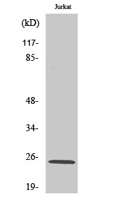 Anti-Ribosomal Protein L10L Antibody