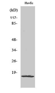 Anti-Ribosomal Protein L26L Antibody