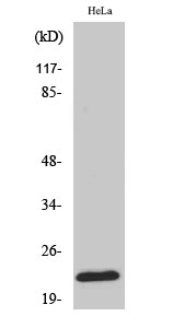 Anti-Ribosomal Protein L18 Antibody