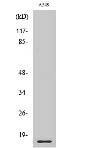 Anti-Ribosomal Protein L28 Antibody