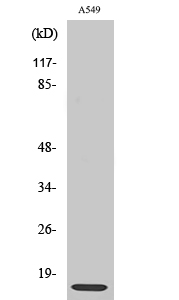 Anti-Ribosomal Protein L30 Antibody