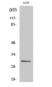 Anti-Ribosomal Protein S8 Antibody