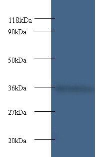 Anti-Cytochrome c1, heme protein, mitochondrial Antibody