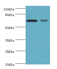 Anti-X-ray repair cross-complementing protein 6 Antibody