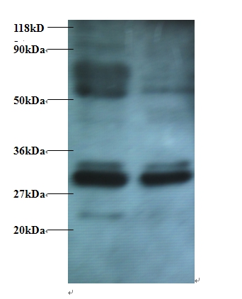 Anti-Endoplasmic reticulum resident protein 29 Antibody