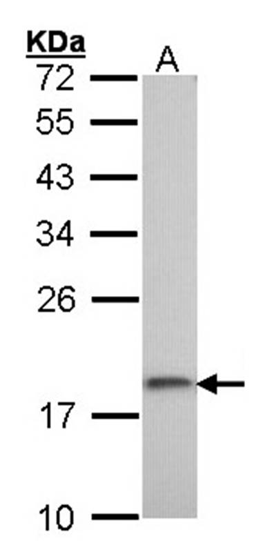 Anti-ribosomal protein S10 Antibody