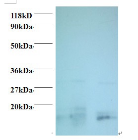 Anti-Charged multivesicular body protein 2a Antibody