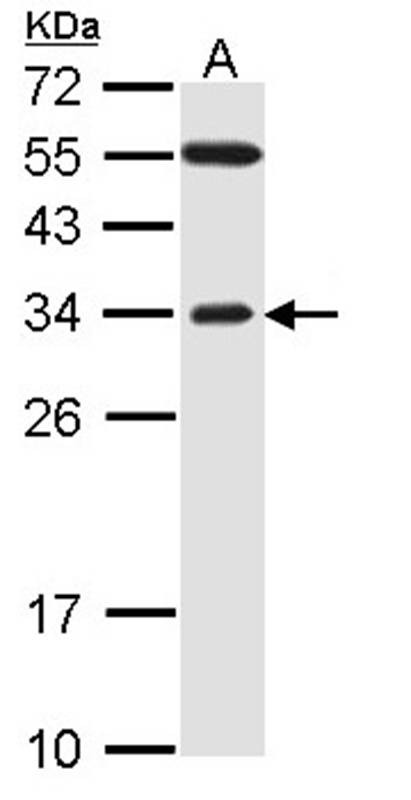 Anti-F-box only protein 2 Antibody