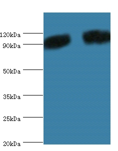 Anti-Periostin Antibody