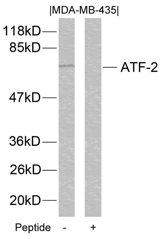 Anti-ATF2 (Ab-112 or 94) Antibody