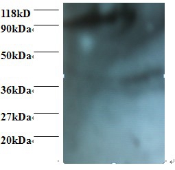 Anti-HCLS1-associated protein X-1 Antibody