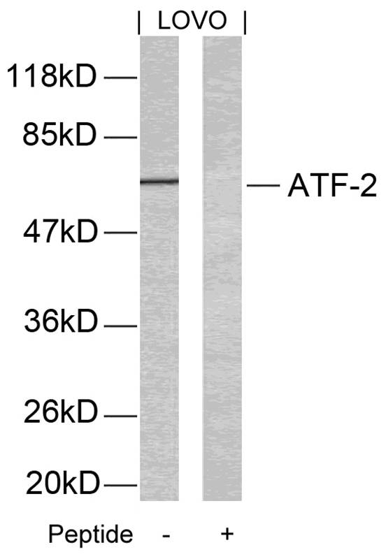 Anti-ATF2 (Ab-69 or 51) Antibody