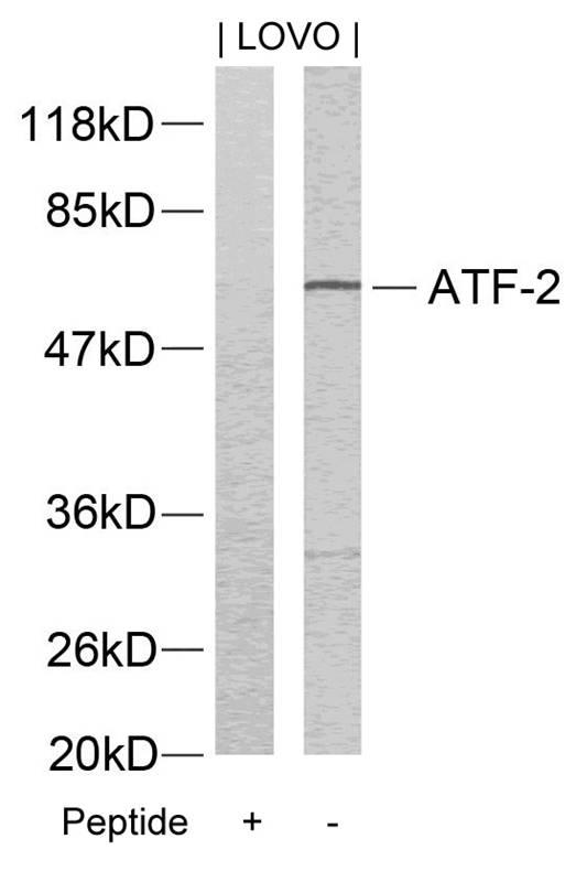 Anti-ATF2 (Ab-73 or 55) Antibody