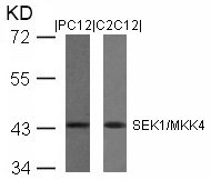 Anti-SEK1 / MKK4 (Ab-80) Antibody