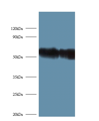 Anti-Ribosomal protein S6 kinase beta-2 Antibody