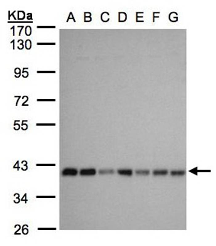 Anti-mitochondrial carrier protein MGC4399 Antibody