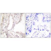 Anti-Prostate Apoptosis Response Protein-4 Antibody