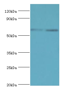 Anti-ASMTL Antibody