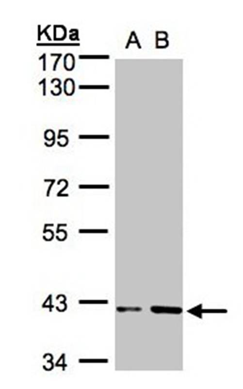 Anti-PRPP synthetase-associated protein 1 Antibody