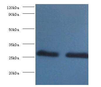 Anti-14-3-3 protein beta / alpha Antibody