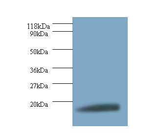 Anti-40S ribosomal protein S11 Antibody