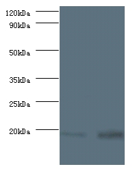 Anti-40S ribosomal protein S13 Antibody