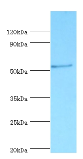 Anti-Vitamin D-binding protein Antibody