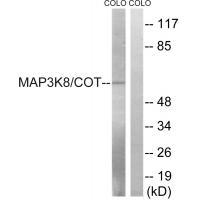 Anti-MAP3K8 (Ab-400) Antibody