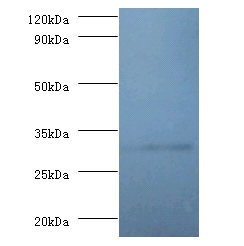 Anti-60S ribosomal protein L5 Antibody