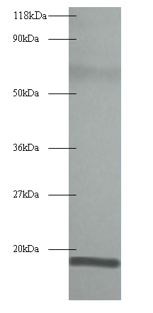 Anti-60S acidic ribosomal protein P1 Antibody