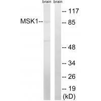Anti-MSK1 (Ab-212) Antibody