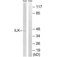 Anti-ILK (Ab-246) Antibody