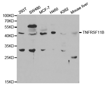 Anti-TNFRSF11B Antibody
