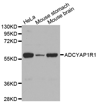 Anti-ADCYAP1R1 Antibody