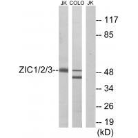 Anti-ZIC1 / 2 / 3 Antibody