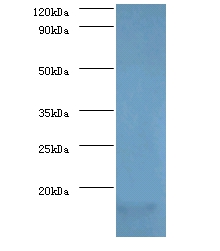 Anti-Myelin P2 protein Antibody